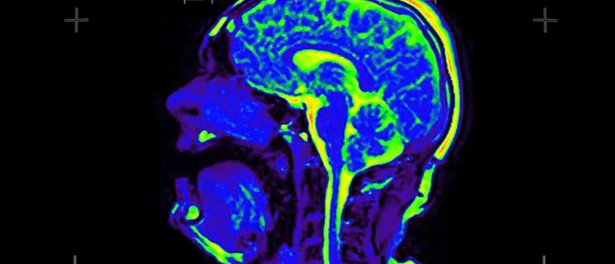 Ένα ιδιαίτερο video clip γυρισμένο σε… τομογράφο!